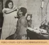 图20:中国红十字会的一位护士正在为眼睛感染的农民治疗。